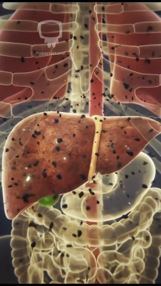 The Silent Danger of Fatty Liver Disease