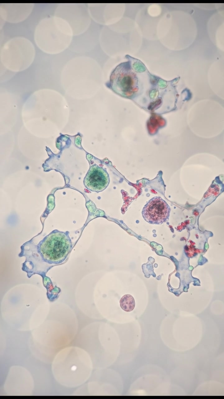 The Amazing Shape-Shifting Cells of Urothelium